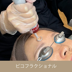 ピコフラクショナル